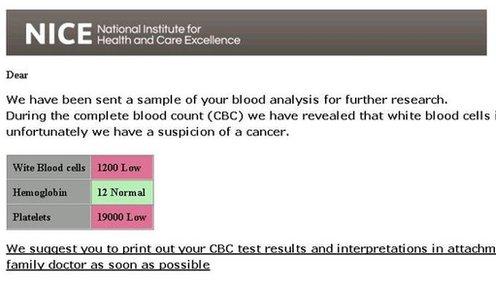 We have been sent a sample of your blood analysis for further research. During the complete blood count (CBC) we have revealed that white blood cells is very low, and unfortunately we have a suspicion of a cancer.